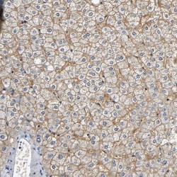SLCO2B1 Antibody, Novus Biologicals 0.1mL; Unlabeled:Antibodies, Polyclonal